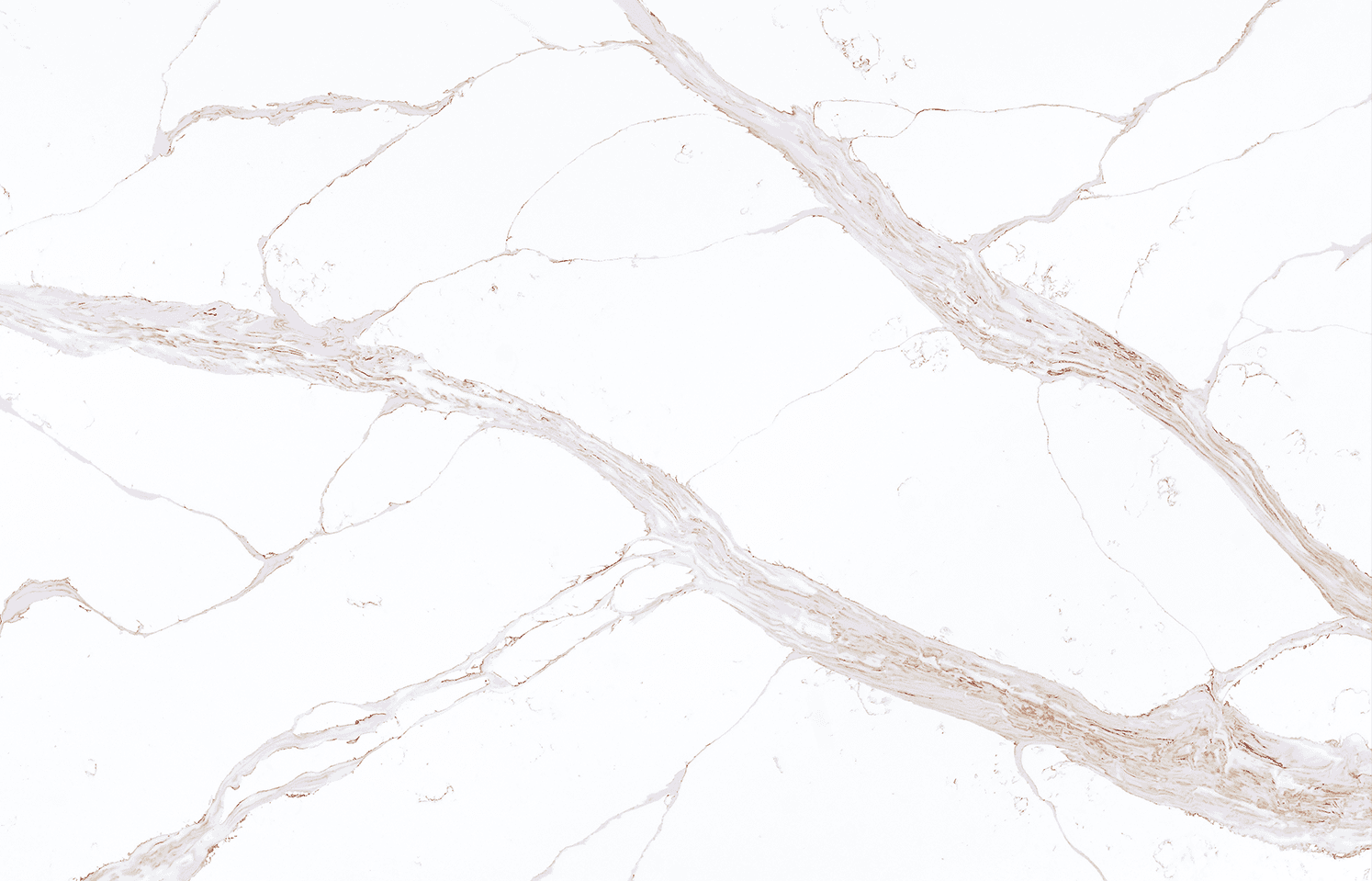 Fountain Gold, quartz slab